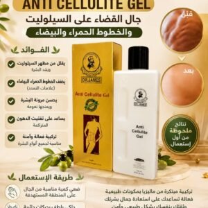 جال القضاء على سيلوليت وًخطوط الحمراء و البيضاء dr James